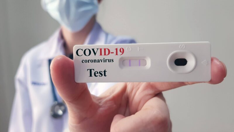 Testagem de covid-19 disponível em seis Unidades de Saúde, mediante agendamento